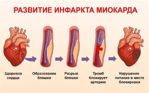 Как происходит сокращение миокарда?