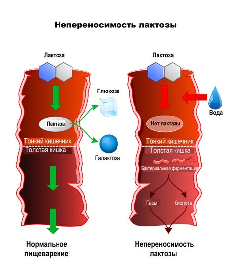 Как проявляется пренебрежительность?