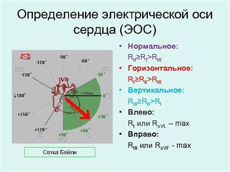 Как работает Эос промежуточная?