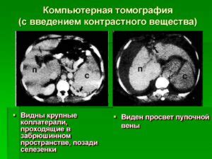 Как работает контрастное усиление?