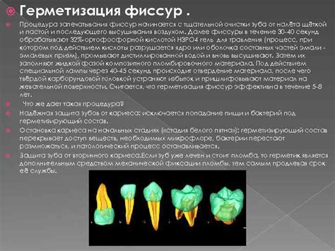 Как работает процедура запечатывания зубков