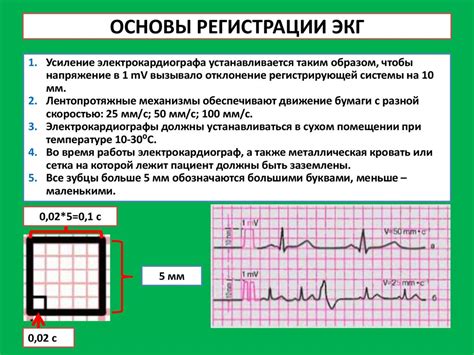 Как работает режектор в процессе ЭКГ