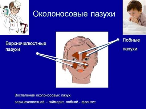 Как работают пневматизированные пазухи околоносовые