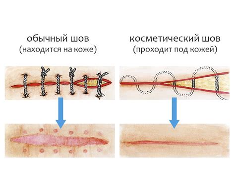 Как разбираться в снах о операции на животе?