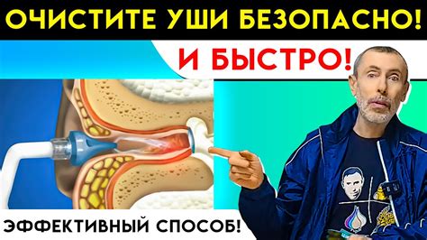 Как развесить уши безопасно и эффективно?