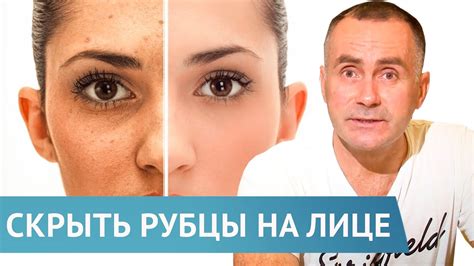 Как распознать неоднородный рубец?