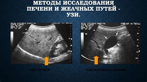 Как расшифровать КВР при УЗИ печени