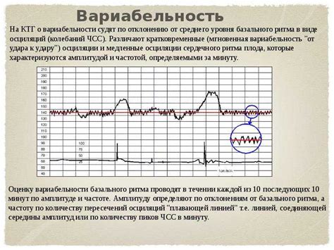 Как расшифровать подозрительный тип КТГ