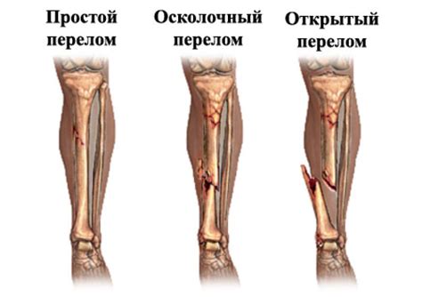 Как сон о повреждении нижней конечности может отражать физические проблемы