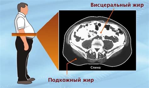 Как уменьшить висцеральный и подкожный жир