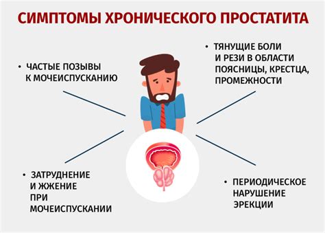 Калькулезный простатит: симптомы и причины развития