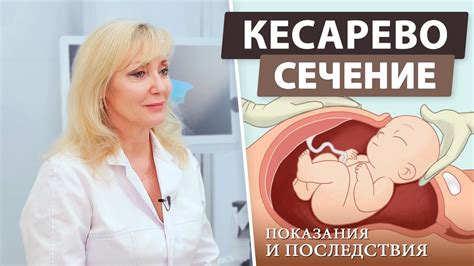 Кесарево сечение: что это и когда назначается