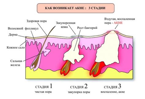 Кистозное содержимое как показатель этиологии