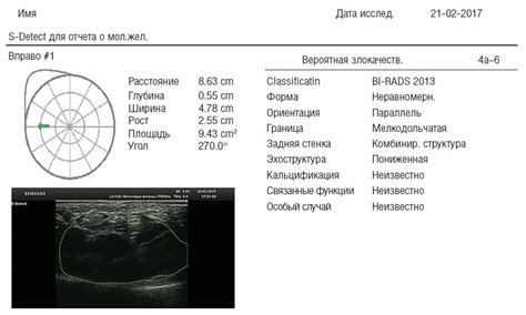 Классификация очаговых изменений: