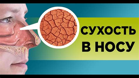 Климатические условия и сухость носа