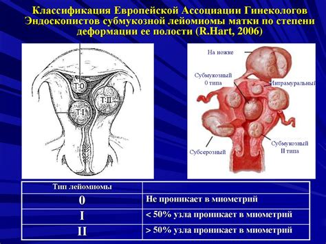 Клинические проявления гипоэхогенного узла в матке