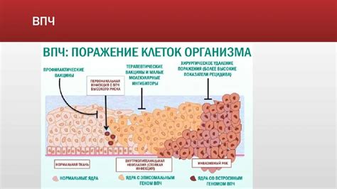 Клинические проявления малозначимого ВПЧ