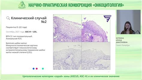 Клиническое значение отсутствия йоднегативной зоны