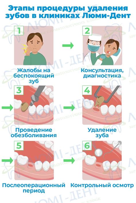 Когда необходимо провести удаление мудрого зуба