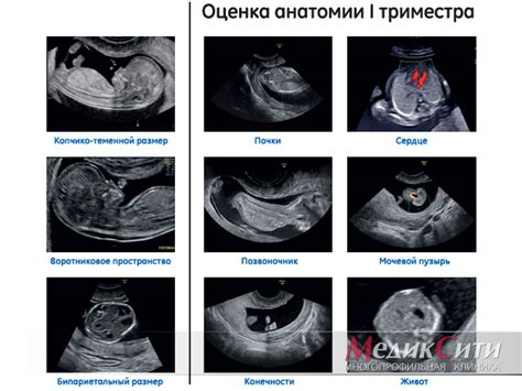 Когда нижняя линия на КТГ может быть повышена