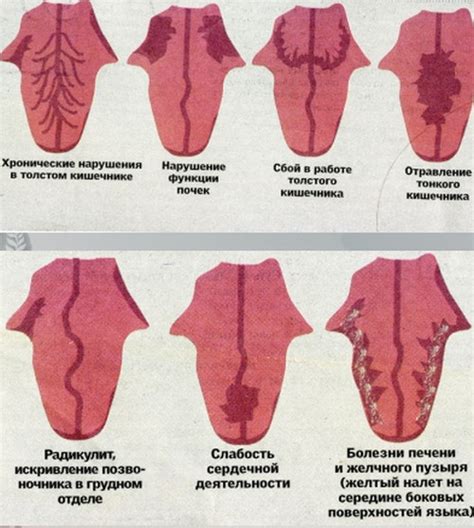 Когда показывание языка может быть симптомом заболевания