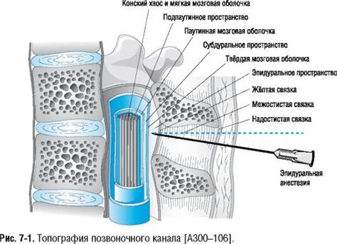 Когда применяется спинномозговая анестезия