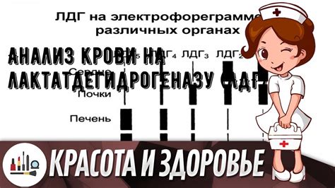 Компоненты ЛДГ 250