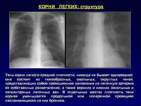 Корни рентгеновских образований