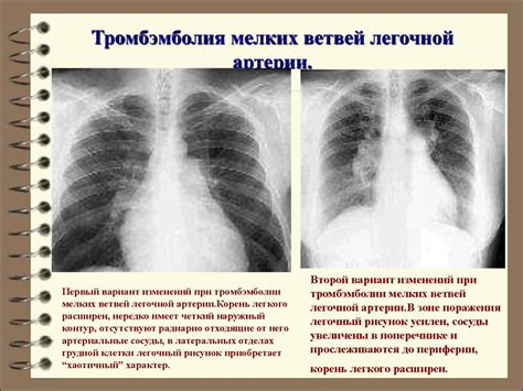 Корни уплотнены на флюорограмме: что это означает?