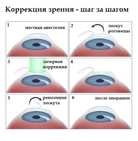 Коррекция зрения 100: понятие и применение