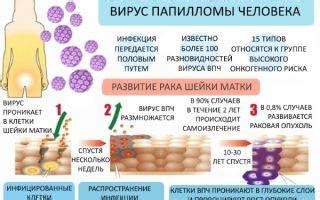 Косвенные признаки ВПЧ при цитологии