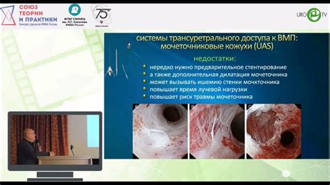 Криогенная медицина: революция в лечении заболеваний