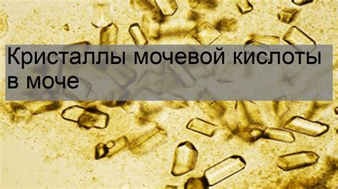 Кристаллы мочевой кислоты у ребенка