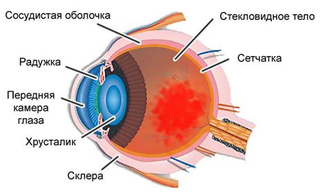 Кровоподтек