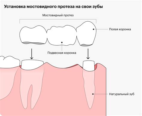 Культурные толкования видения о движении зуба во воображении