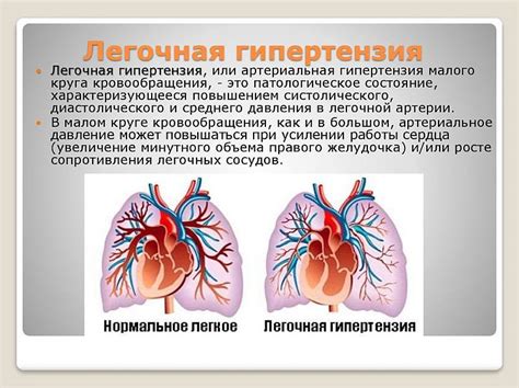 Легочная гипертензия: основные причины