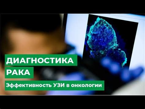 Лейкоцитарная реакция: суть, особенности и способы лечения