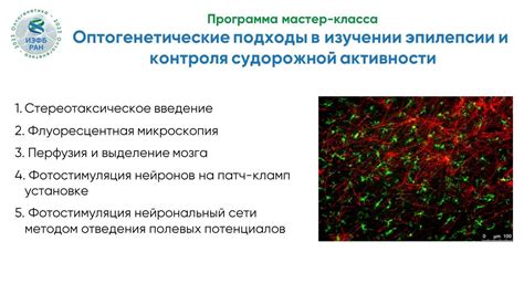 Лекарства для контроля судорожной активности