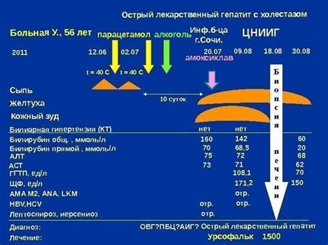 Лекарственный гепатит: общая информация