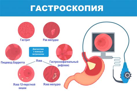 Лечение атрофии желудка и возможности восстановления