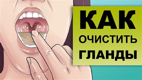 Лечение болей в гланды: как избавиться от неприятных симптомов