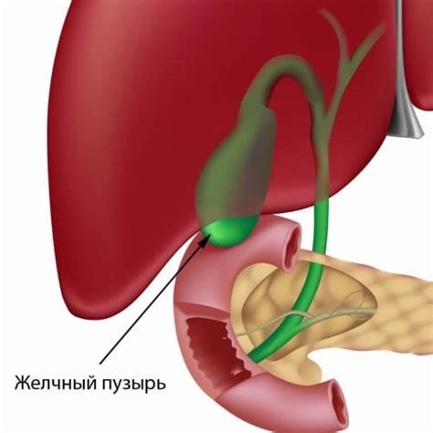 Лечение гангрены желчного пузыря