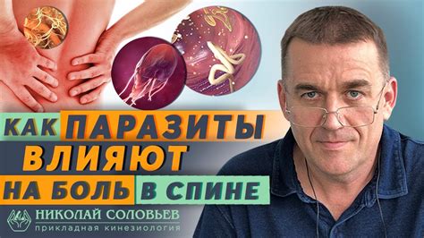 Лечение глистов народными средствами