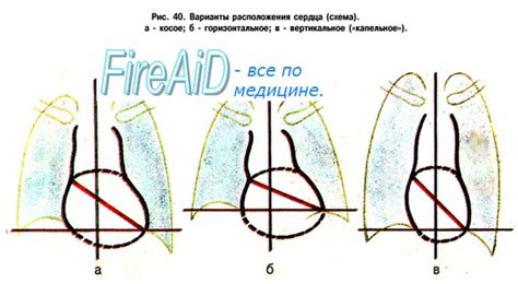 Лечение горизонтальной оси сердца у мужчин: методы и рекомендации