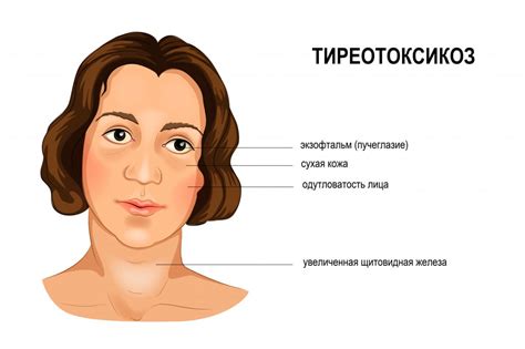 Лечение гормональных нарушений