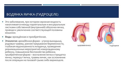 Лечение гуляющего яичка у мальчика