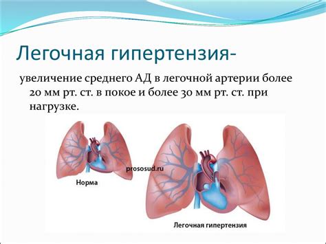 Лечение и прогноз при сердце двоедушном: