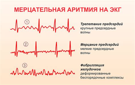 Лечение и профилактика венцевой мерцательной кровотечки