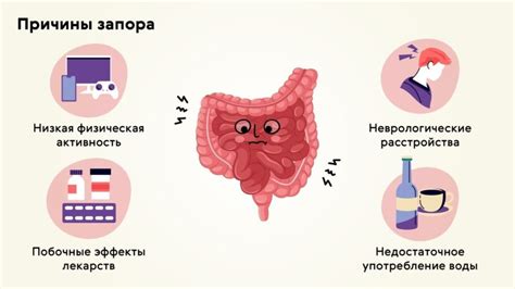 Лечение и профилактика стойкого запора