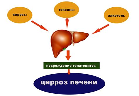 Лечение компенсированного цирроза печени